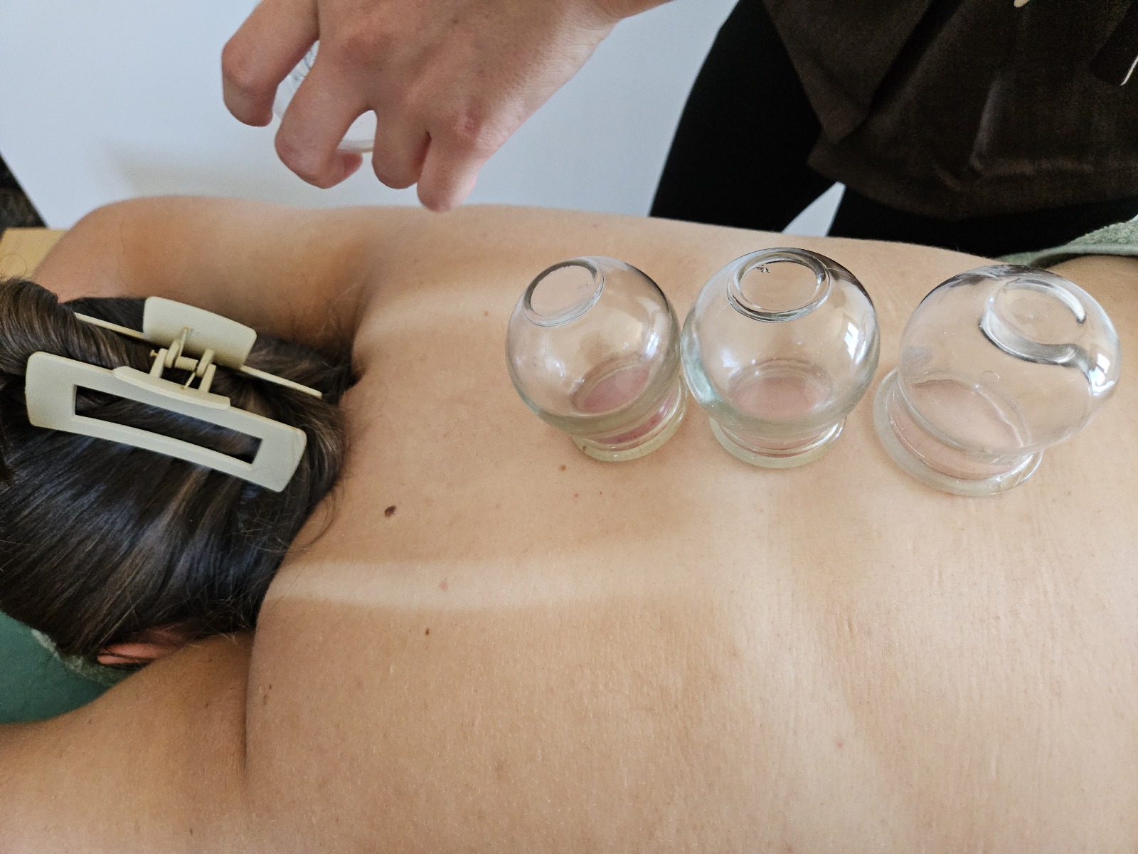 Massage aux ventouses